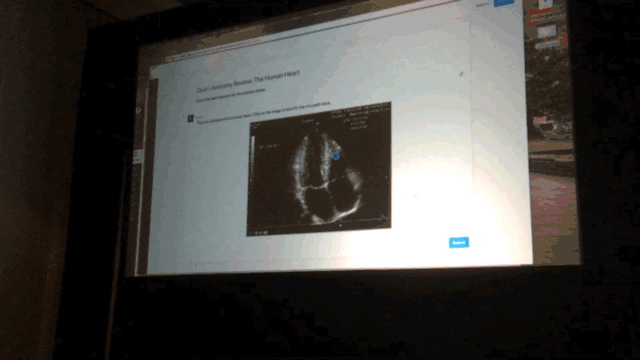 244793_IMG_0150.GIF 244793_IMG_0150.GIF